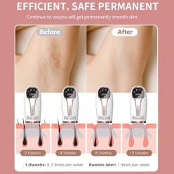 Depilator Laserowy Błyskowy IPL 9 Poziomów Mocy